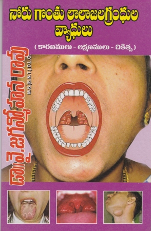 Noru Gontu Lalajala Grandhula Vyadhulu Telugu Book By Dr. Y.Jaganmohan Rao
